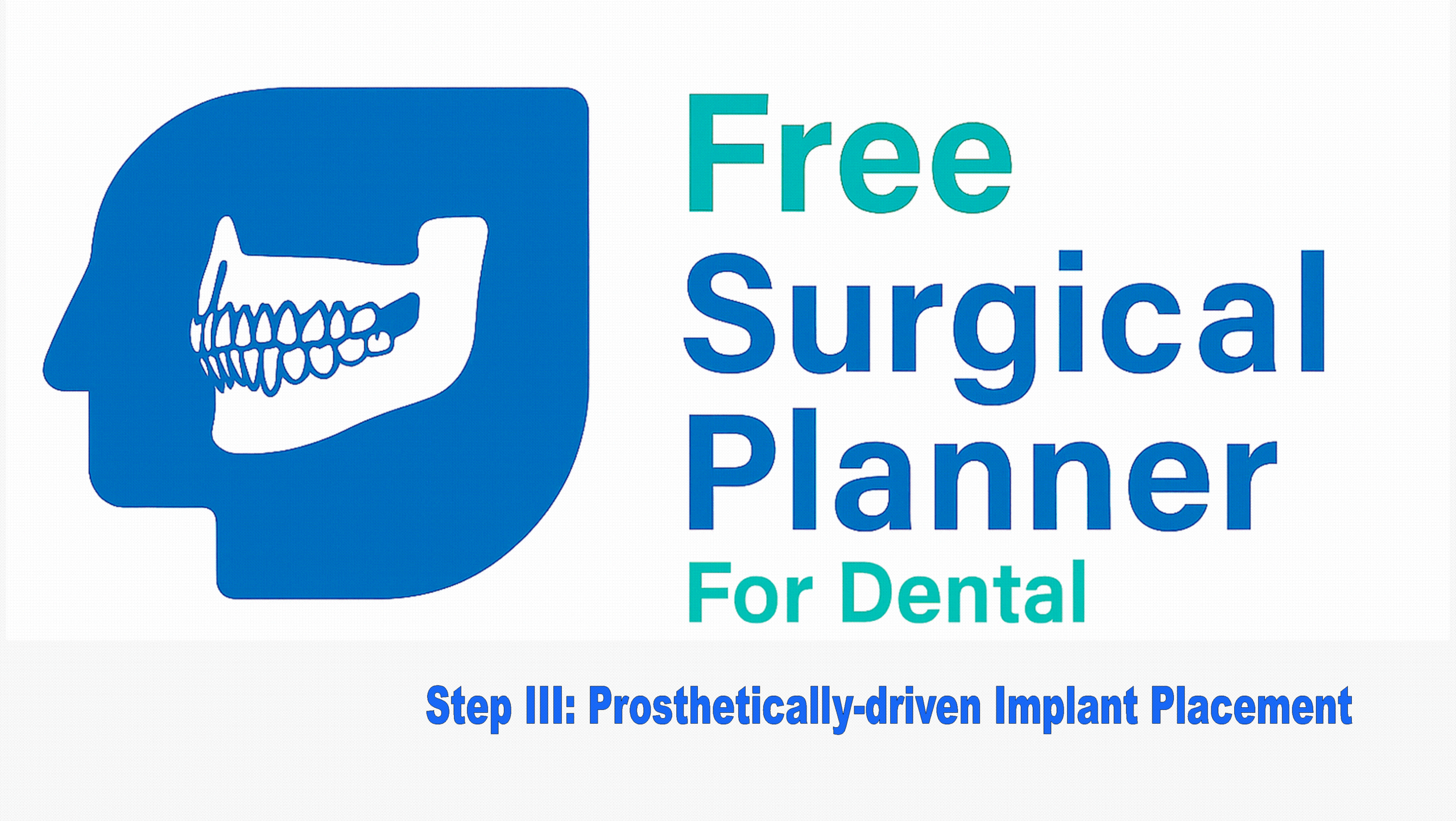 Free Surgical Planner for Dental – Step III: Prosthetically-driven Implant Placement Simulation