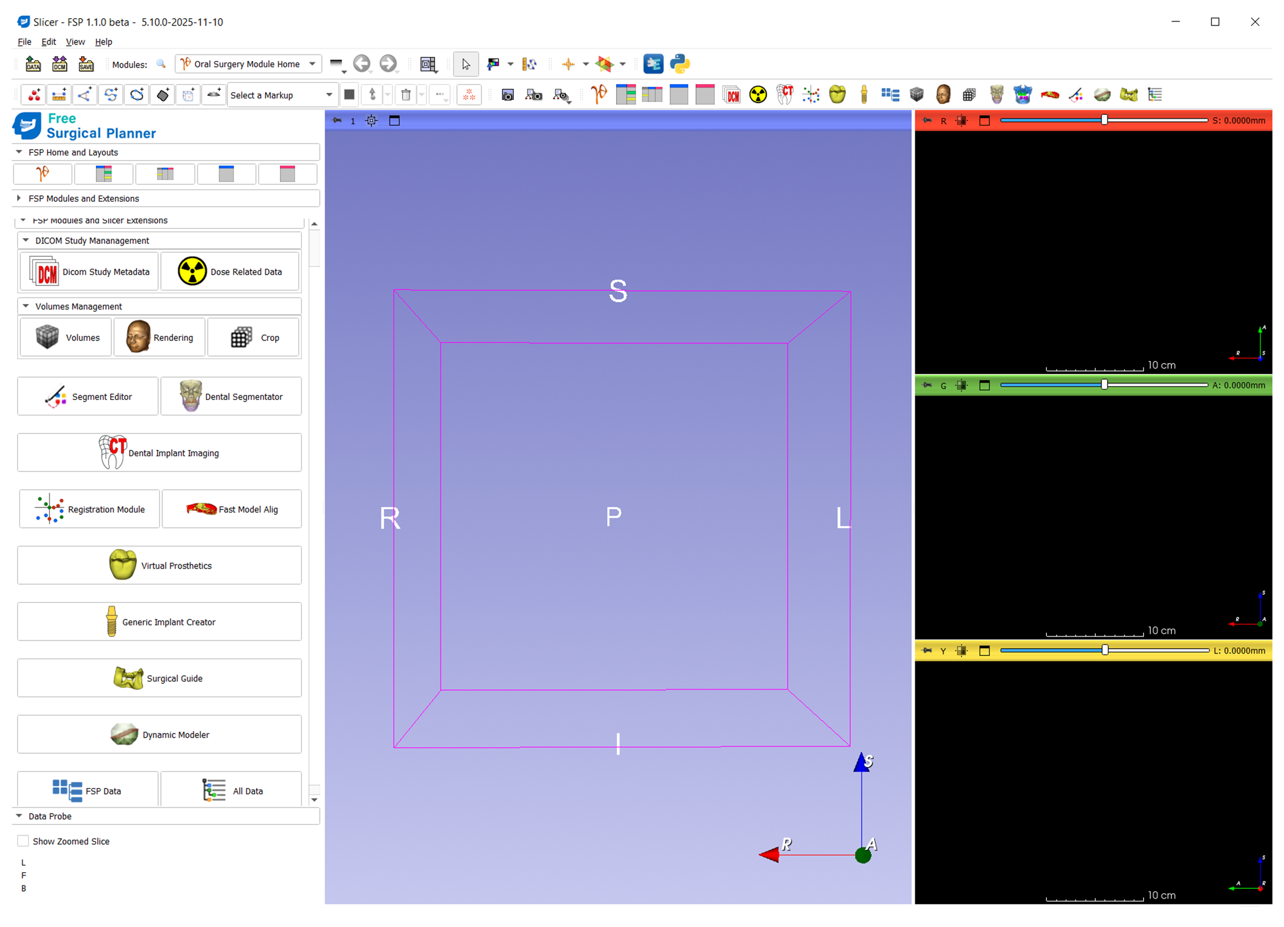 Free Surgical Planner: First Updated Release Now Available