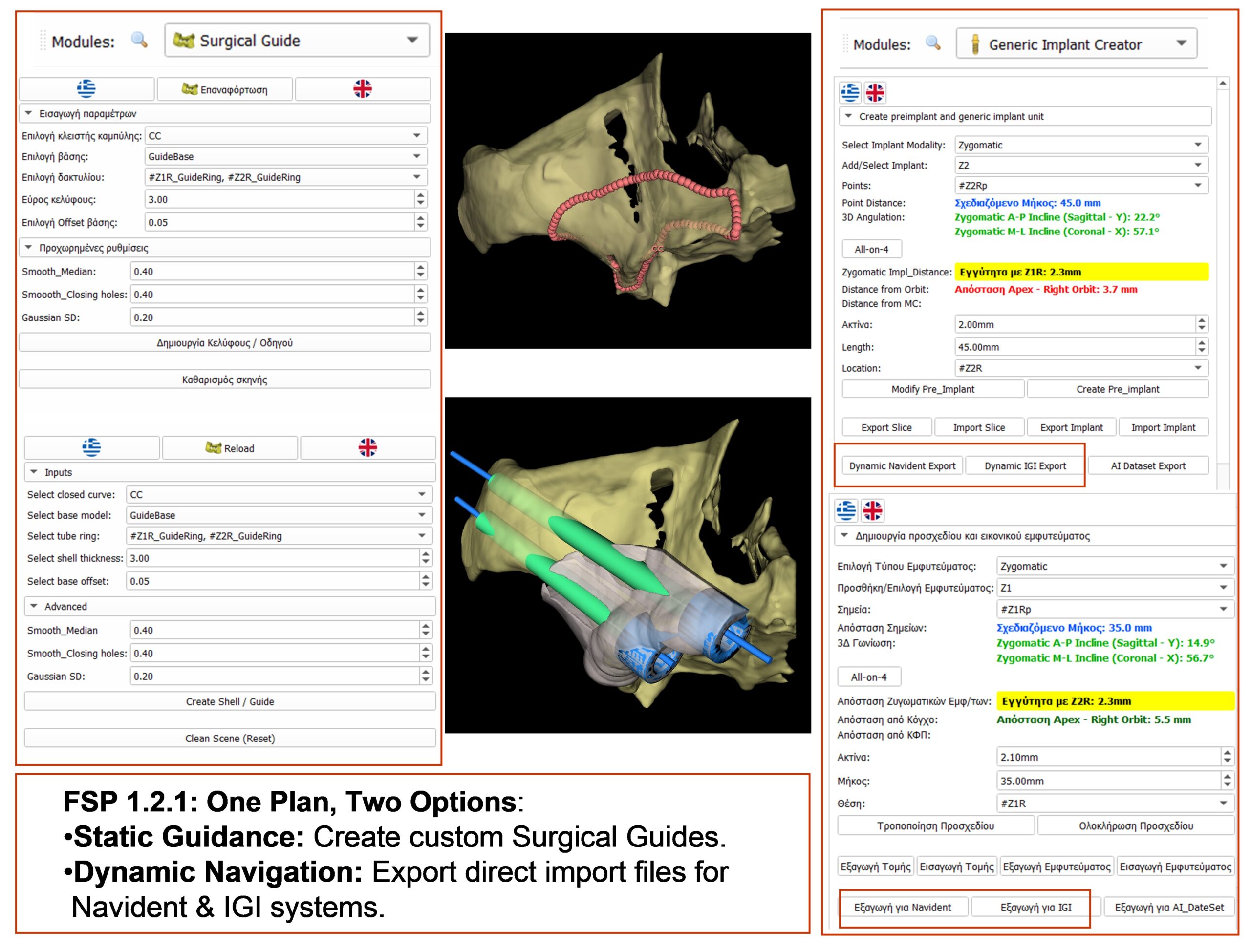 FSP 1.2.1: One Plan, Two Options: Static Guidance & Dynamic Navigation / Ένα Σχέδιο, Δύο Επιλογές: Στατική Καθοδήγηση & Δυναμική Πλοήγηση.